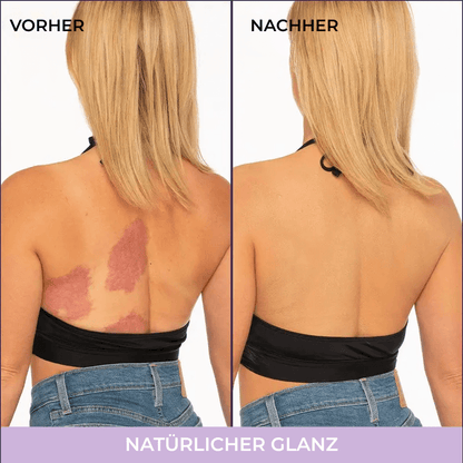 SkinVeil™ | Körper-Make-up