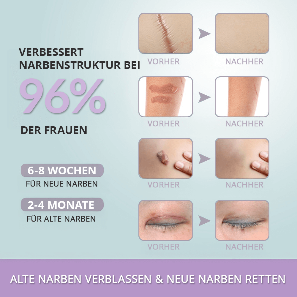 ScarRelief ™ | Silikon-Narbenpflaster