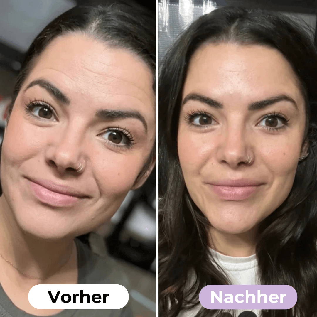 ScarRelief ™ | Silikon-Narbenpflaster